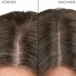 Anti-Schuppen Shampoo 250 ml