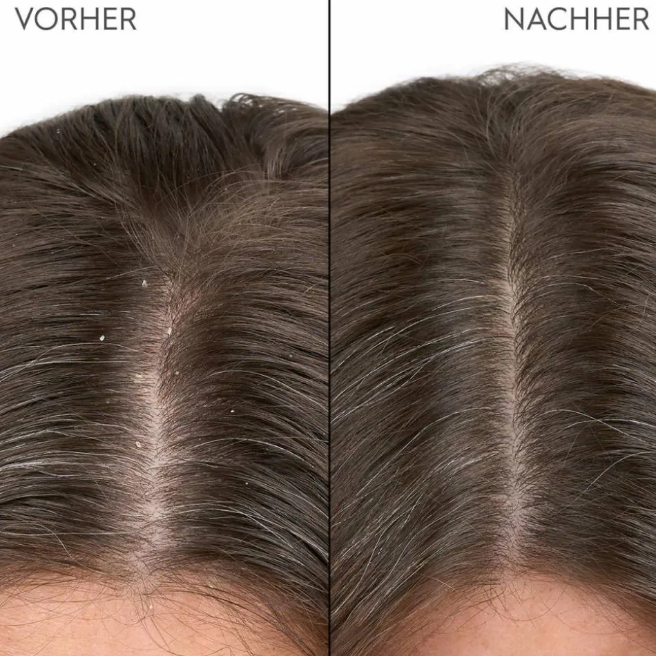 Anti-Schuppen Shampoo 250 ml