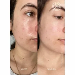 Barrier Restoring Hydrating Cream 50 ml