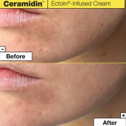 Ceramidin™ Ectoin-Infused Cream 50 ml