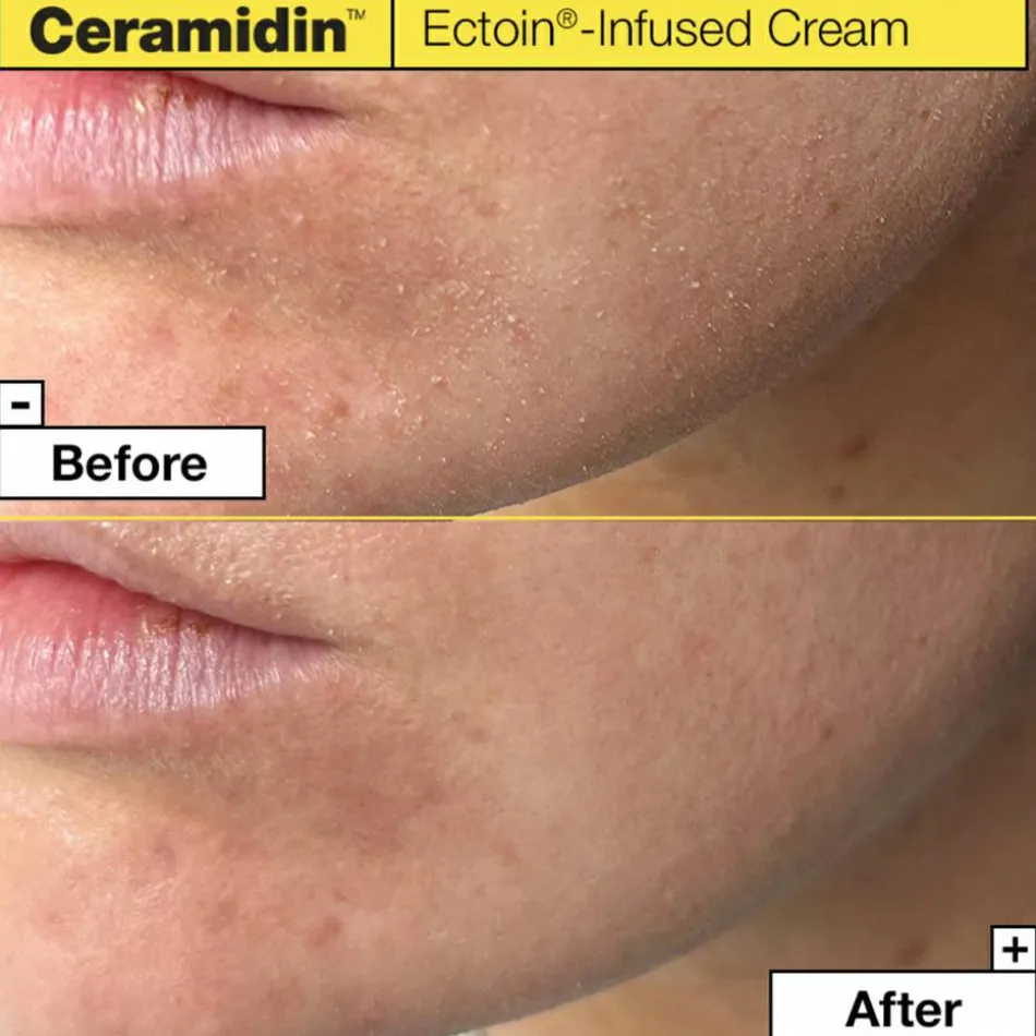 Ceramidin™ Ectoin-Infused Cream 50 ml