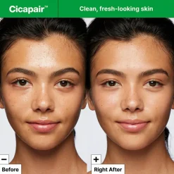Cicapair™ Gentle Cleansing Foam 150 ml