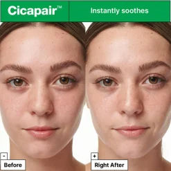 Cicapair™ Intensive Soothing Repair Serum 30 ml