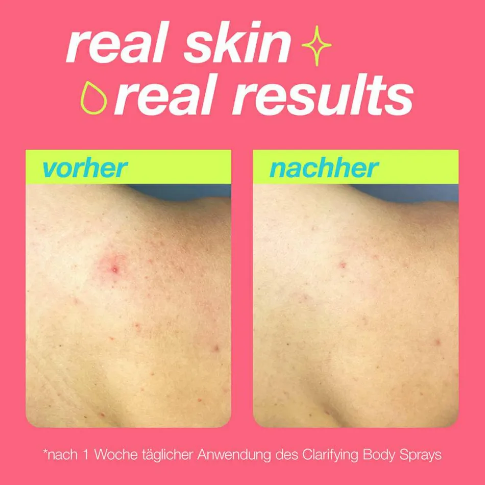 Clarifying Body Spray 177 ml