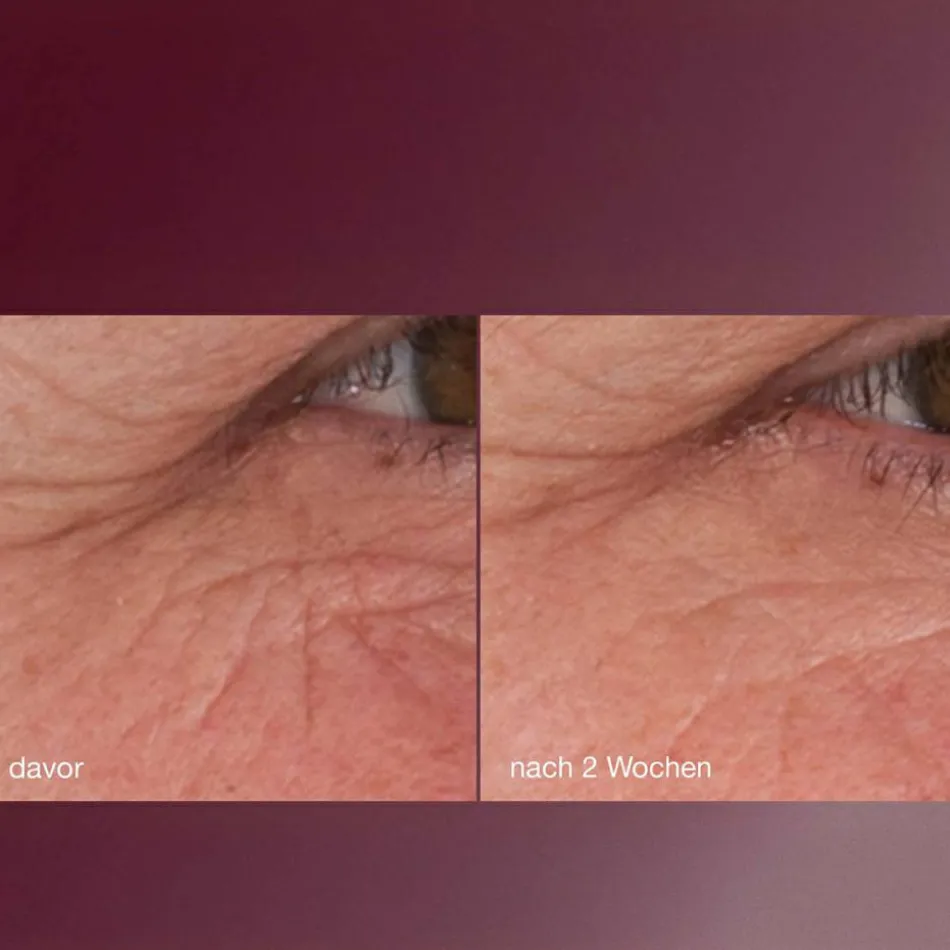 Dynamic Skin Retinol Serum 30 ml