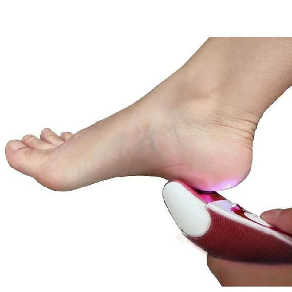 Easy Pedipeel Roller