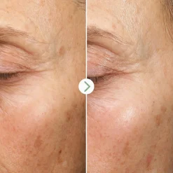 Fade Forward Dark Spot Serum 30 ml