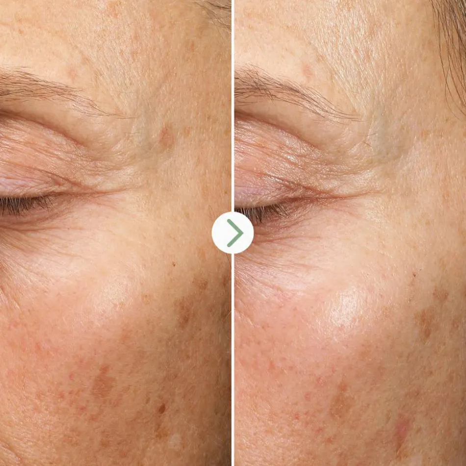 Fade Forward Dark Spot Serum 30 ml