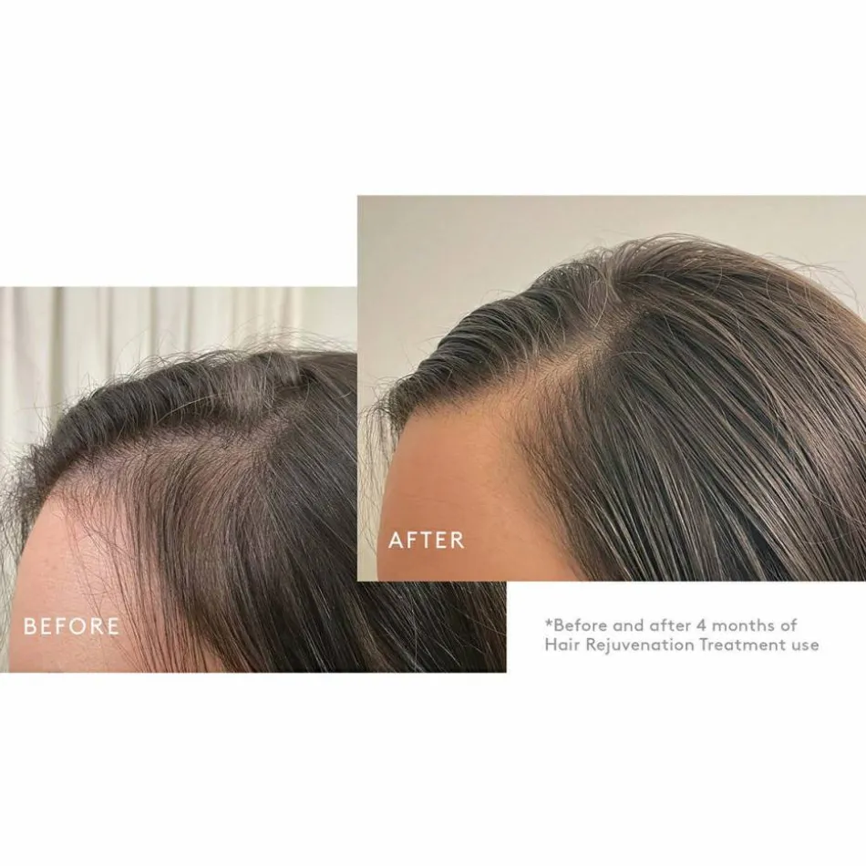 Flourish Hair Rejuvenation Treatment 1 month supply Set