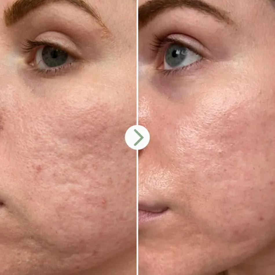 Hyaluronic Acid Hydrating Booster 10 ml