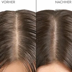Kopfhaut & Haar Peeling 200 ml