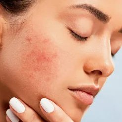MED+ Anti-Red  RR Cream Redness Reduction SPF 30 30 ml