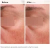 Niacinamide 5% Face & Body Emulsion 100 ml