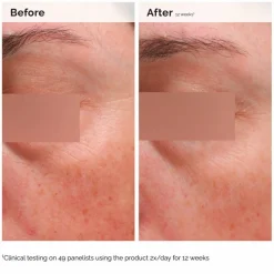 Niacinamide 5% Face & Body Emulsion 100 ml
