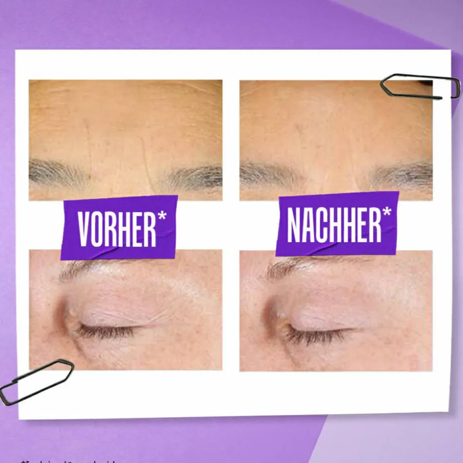 Retinol Skin-Renewing Daily Micro-Dose Serum