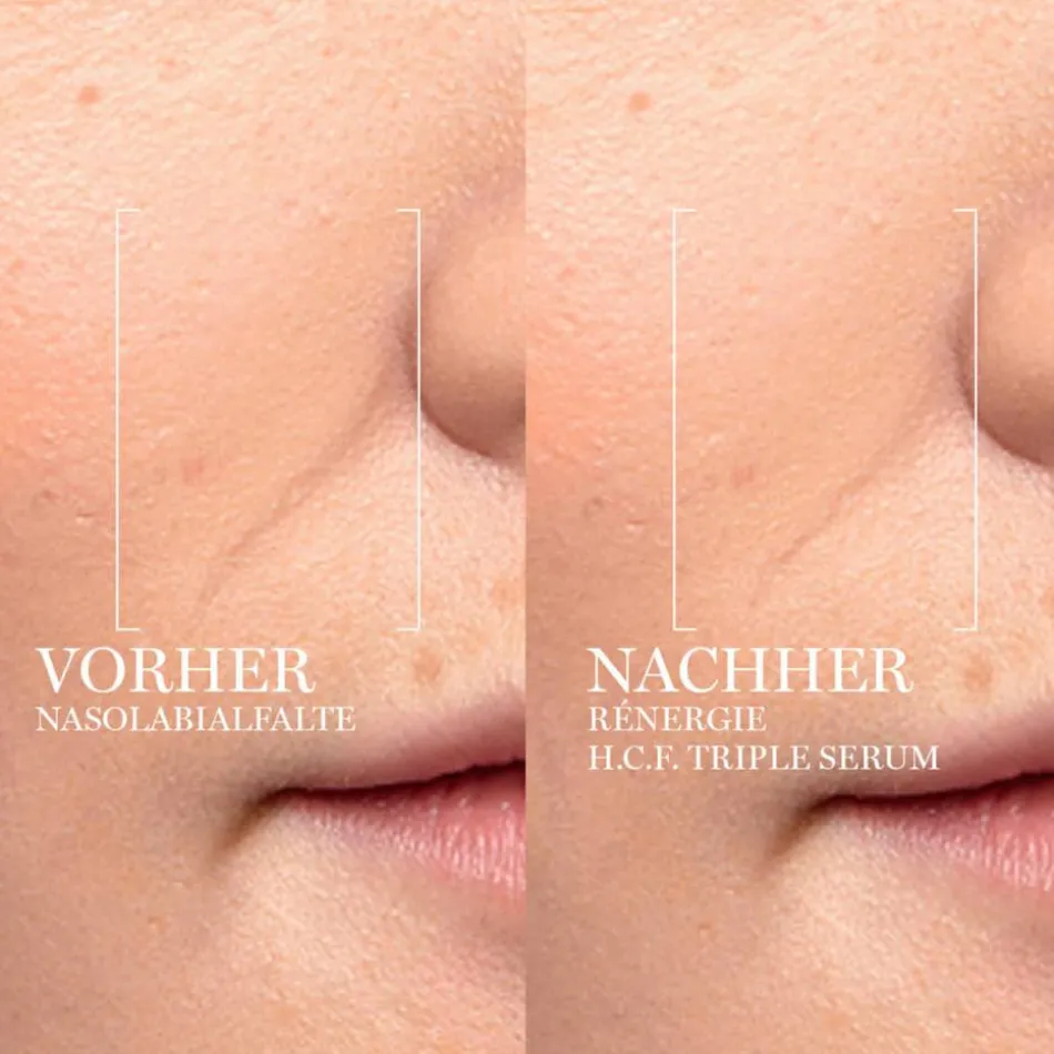 Rénergie H.C.F. Triple Serum 50 ml