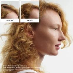 Scalp + Hair System 1 Haarpflegesystem-Kit