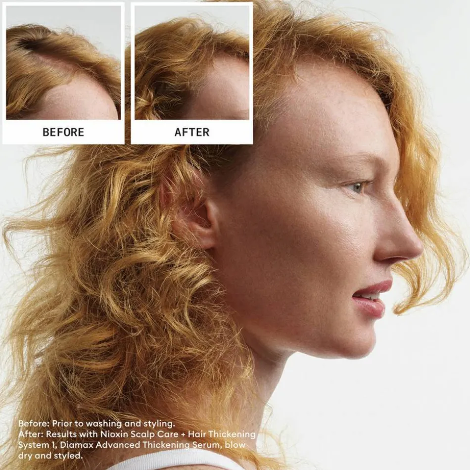 Scalp + Hair System 1 Haarpflegesystem-Kit