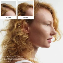 Scalp + Hair System 1 Treatment 100 ml