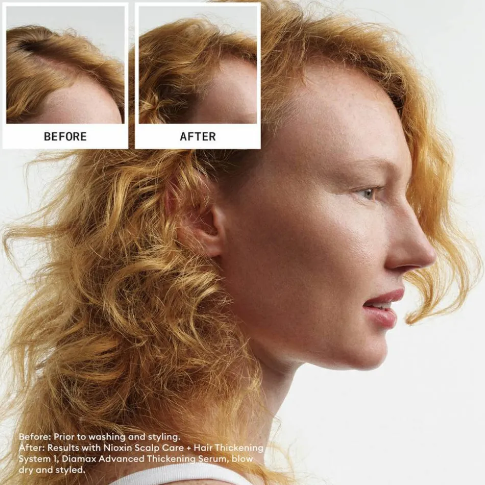Scalp + Hair System 1 Treatment 100 ml