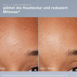 Skin Health System Daily Microfoliant Gesichtspeeling 74 g
