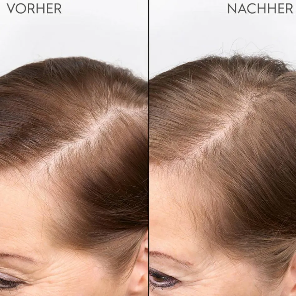 Verdichtendes Kopfhaut Serum 100 ml