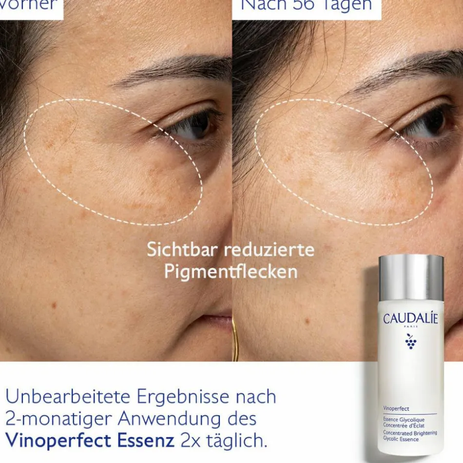 Vinoperfect Essenz mit Glykolsäure 100 ml